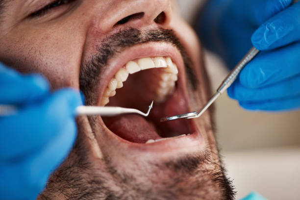 Best Emergency Dental Extractions in Charleston, WV
